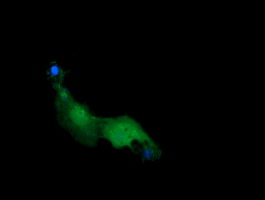 RAB21 Antibody - Anti-RAB21 mouse monoclonal antibody immunofluorescent staining of COS7 cells transiently transfected by pCMV6-ENTRY RAB21.