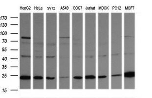 RAB21 Antibody - Western blot of extracts (35 ug) from 9 different cell lines by using anti-RAB21 monoclonal antibody (HepG2: human; HeLa: human; SVT2: mouse; A549: human; COS7: monkey; Jurkat: human; MDCK: canine; PC12: rat; MCF7: human).