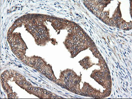 RAB21 Antibody - IHC of paraffin-embedded Human prostate tissue using anti-RAB21 mouse monoclonal antibody.