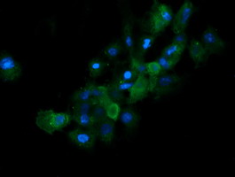 RAB21 Antibody - Anti-RAB21 mouse monoclonal antibody immunofluorescent staining of COS7 cells transiently transfected by pCMV6-ENTRY RAB21.