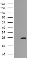 RAB21 Antibody - HEK293T cells were transfected with the pCMV6-ENTRY control (Left lane) or pCMV6-ENTRY RAB21 (Right lane) cDNA for 48 hrs and lysed. Equivalent amounts of cell lysates (5 ug per lane) were separated by SDS-PAGE and immunoblotted with anti-RAB21.