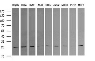 RAB21 Antibody - Western blot of extracts (35 ug) from 9 different cell lines by using anti-RAB21 monoclonal antibody (HepG2: human; HeLa: human; SVT2: mouse; A549: human; COS7: monkey; Jurkat: human; MDCK: canine; PC12: rat; MCF7: human).