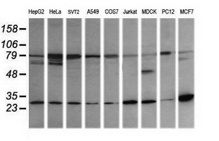 RAB21 Antibody - Western blot of extracts (35 ug) from 9 different cell lines by using g anti-RAB21 monoclonal antibody (HepG2: human; HeLa: human; SVT2: mouse; A549: human; COS7: monkey; Jurkat: human; MDCK: canine; PC12: rat; MCF7: human).