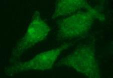 RAB21 Antibody - Immunofluorescent staining of HeLa cells using anti-RAB21 mouse monoclonal antibody.