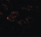 RAB21 Antibody - Immunofluorescence of RAB21 in human kidney tissue with RAB21 antibody at 20 ug/ml.