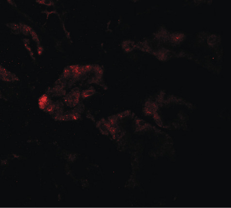RAB21 Antibody - Immunofluorescence of RAB21 in human kidney tissue with RAB21 antibody at 20 ug/ml.
