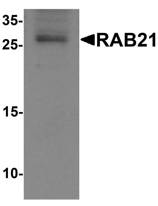 RAB21 Antibody - Western blot analysis of RAB21 in mouse kidney tissue lysate with RAB21 antibody at 1 ug/ml.