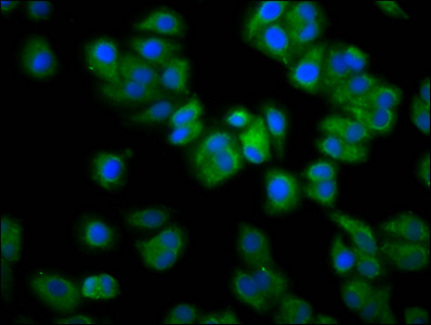 RAB21 Antibody - Immunofluorescence staining of HepG2 cells diluted at 1:133, counter-stained with DAPI. The cells were fixed in 4% formaldehyde, permeabilized using 0.2% Triton X-100 and blocked in 10% normal Goat Serum. The cells were then incubated with the antibody overnight at 4°C.The Secondary antibody was Alexa Fluor 488-congugated AffiniPure Goat Anti-Rabbit IgG (H+L).