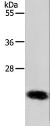 RAB22A / RAB22 Antibody - Western blot analysis of MCF-7 cell, using RAB22A Polyclonal Antibody at dilution of 1:650.
