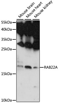 RAB22A / RAB22 Antibody - Western blot analysis of extracts of various cell lines, using RAB22A antibody at 1:1000 dilution. The secondary antibody used was an HRP Goat Anti-Rabbit IgG (H+L) at 1:10000 dilution. Lysates were loaded 25ug per lane and 3% nonfat dry milk in TBST was used for blocking. An ECL Kit was used for detection and the exposure time was 90s.