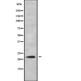 RAB22A / RAB22 Antibody - Western blot analysis of RAB22A using HT29 whole cells lysates