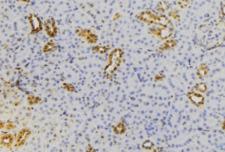 RAB22A / RAB22 Antibody - 1:100 staining mouse kidney tissue by IHC-P. The sample was formaldehyde fixed and a heat mediated antigen retrieval step in citrate buffer was performed. The sample was then blocked and incubated with the antibody for 1.5 hours at 22°C. An HRP conjugated goat anti-rabbit antibody was used as the secondary.