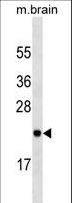 RAB23 Antibody - RAB23 Antibody western blot of mouse brain tissue lysates (35 ug/lane). The RAB23 antibody detected the RAB23 protein (arrow).