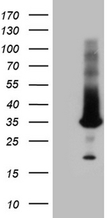 RAB23 Antibody - HEK293T cells were transfected with the pCMV6-ENTRY control. (Left lane) or pCMV6-ENTRY RAB23. (Right lane) cDNA for 48 hrs and lysed. Equivalent amounts of cell lysates. (5 ug per lane) were separated by SDS-PAGE and immunoblotted with anti-RAB23. (1:2000)