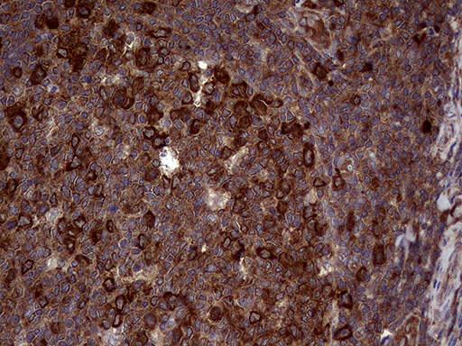 RAB23 Antibody - Immunohistochemical staining of paraffin-embedded Human tonsil within the normal limits using anti-RAB23 mouse monoclonal antibody. (Heat-induced epitope retrieval by 1mM EDTA in 10mM Tris buffer. (pH8.5) at 120°C for 3 min. (1:2000)