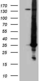 RAB23 Antibody - HEK293T cells were transfected with the pCMV6-ENTRY control. (Left lane) or pCMV6-ENTRY RAB23. (Right lane) cDNA for 48 hrs and lysed. Equivalent amounts of cell lysates. (5 ug per lane) were separated by SDS-PAGE and immunoblotted with anti-RAB23. (1:2000)