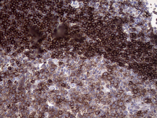 RAB23 Antibody - Immunohistochemical staining of paraffin-embedded Human lymph node tissue within the normal limits using anti-RAB23 mouse monoclonal antibody. (Heat-induced epitope retrieval by 1mM EDTA in 10mM Tris buffer. (pH8.5) at 120°C for 3 min. (1:2000)