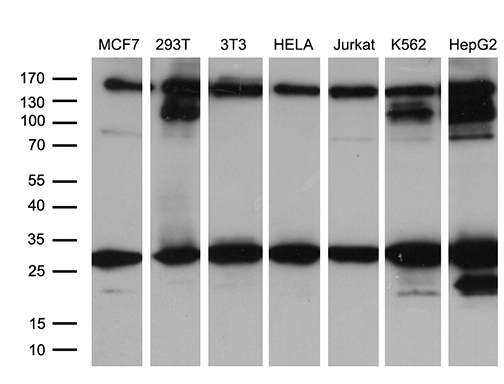 RAB23 Antibody - Western blot analysis of extracts. (35ug) from 7 different cell lines by using anti-RAB23 monoclonal antibody. (1:500)