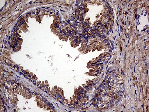 RAB23 Antibody - Immunohistochemical staining of paraffin-embedded Human prostate tissue within the normal limits using anti-RAB23 mouse monoclonal antibody. (Heat-induced epitope retrieval by 1mM EDTA in 10mM Tris buffer. (pH8.5) at 120°C for 3 min. (1:500)