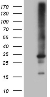 RAB23 Antibody - HEK293T cells were transfected with the pCMV6-ENTRY control. (Left lane) or pCMV6-ENTRY RAB23. (Right lane) cDNA for 48 hrs and lysed