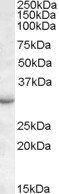 RAB23 Antibody - Antibody (0.1 ug/ml) staining of Mouse Eye lysate (35 ug protein in RIPA buffer). Primary incubation was 1 hour. Detected by chemiluminescence