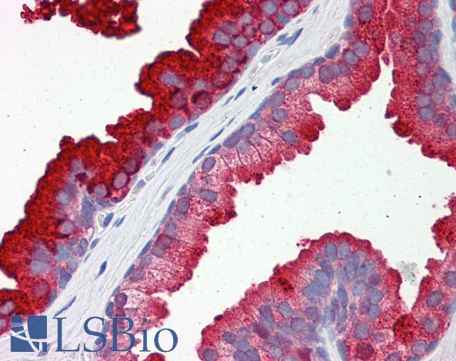 RAB23 Antibody - Anti-RAB23 antibody IHC of human prostate. Immunohistochemistry of formalin-fixed, paraffin-embedded tissue after heat-induced antigen retrieval. Antibody concentration 5 ug/ml.  This image was taken for the unconjugated form of this product. Other forms have not been tested.