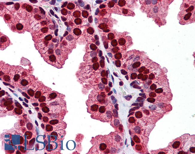 RAB23 Antibody - Anti-RAB23 antibody IHC of human prostate. Immunohistochemistry of formalin-fixed, paraffin-embedded tissue after heat-induced antigen retrieval. Antibody concentration 5 ug/ml.  This image was taken for the unconjugated form of this product. Other forms have not been tested.