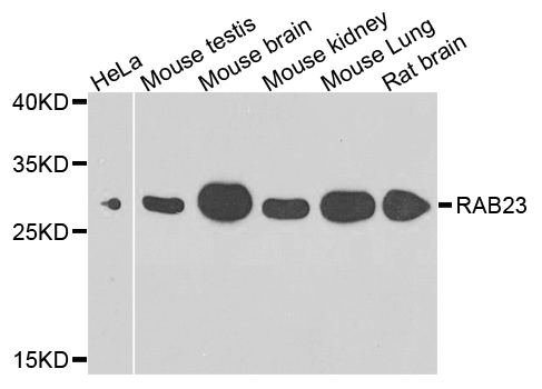 RAB23 Antibody - Western blot analysis of extracts of various cell lines.