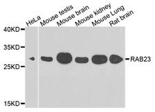 RAB23 Antibody - Western blot analysis of extracts of various cell lines.