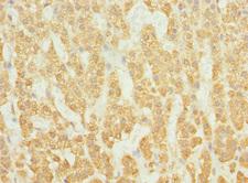 RAB23 Antibody - Immunohistochemistry of paraffin-embedded human adrenal gland tissue at dilution 1:100