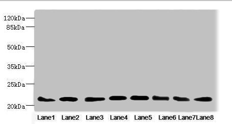 RAB23 Antibody - Western blot All Lanes: RAB23 antibody at 3.88ug/ml Lane 1: Mouse oc ular tissue Lane 2: Rat brain tissue Lane 3: Mouse kidney tissue Lane 4: Mouse lung tissue Lane 5: Mouse brain tissue Lane 6: NIH/3T3 whole cell lysate Lane 7: MCF7 whole cell lysate Lane 8: Hela whole cell lysate Secondary Goat polyclonal to Rabbit IgG at 1/10000 dilution Predicted band size: 27 kDa Observed band size: 27 kDa