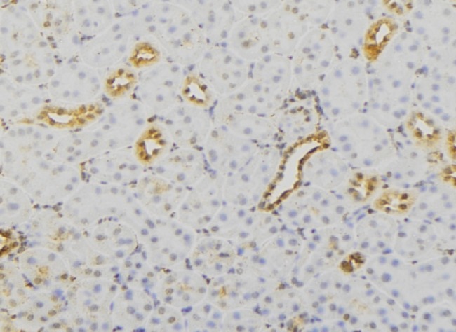 RAB23 Antibody - 1:100 staining mouse kidney tissue by IHC-P. The sample was formaldehyde fixed and a heat mediated antigen retrieval step in citrate buffer was performed. The sample was then blocked and incubated with the antibody for 1.5 hours at 22°C. An HRP conjugated goat anti-rabbit antibody was used as the secondary.