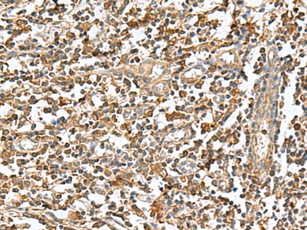 RAB23 Antibody - Immunohistochemistry of paraffin-embedded Human tonsil tissue  using RAB23 Polyclonal Antibody at dilution of 1:50(×200)