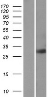 RAB23 Protein - Western validation with an anti-DDK antibody * L: Control HEK293 lysate R: Over-expression lysate