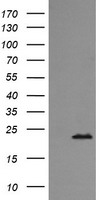 RAB24 Antibody - HEK293T cells were transfected with the pCMV6-ENTRY control (Left lane) or pCMV6-ENTRY RAB24 (Right lane) cDNA for 48 hrs and lysed. Equivalent amounts of cell lysates (5 ug per lane) were separated by SDS-PAGE and immunoblotted with anti-RAB24.