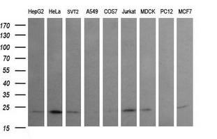 RAB24 Antibody - Western blot of extracts (35 ug) from 9 different cell lines by using anti-RAB24 monoclonal antibody (HepG2: human; HeLa: human; SVT2: mouse; A549: human; COS7: monkey; Jurkat: human; MDCK: canine; PC12: rat; MCF7: human).