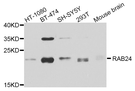 RAB24 Antibody - Western blot analysis of extracts of various cell lines.