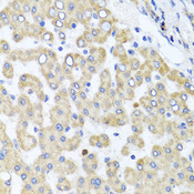 RAB24 Antibody - Immunohistochemistry of paraffin-embedded human liver injury tissue.