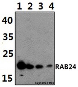 RAB24 Antibody - Western blot of RAB24 polyclonal antibody at 1:500 dilution. Lane 1: HeLa whole cell lysate (40 ug). Lane 2: H9C2 whole cell lysate (40 ug). Lane 3: RAW264.7 whole cell lysate (40 ug). Lane 4: MCF-7 whole cell lysate (40 ug).