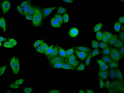 RAB24 Antibody - Immunofluorescence staining of PC3 cells diluted at 1:133, counter-stained with DAPI. The cells were fixed in 4% formaldehyde, permeabilized using 0.2% Triton X-100 and blocked in 10% normal Goat Serum. The cells were then incubated with the antibody overnight at 4°C.The Secondary antibody was Alexa Fluor 488-congugated AffiniPure Goat Anti-Rabbit IgG (H+L).