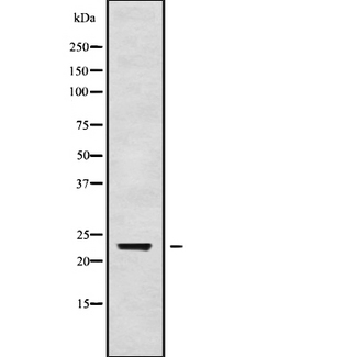 RAB24 Antibody - Western blot analysis of RAB24 using Jurkat whole cells lysates