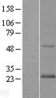 RAB24 Protein - Western validation with an anti-DDK antibody * L: Control HEK293 lysate R: Over-expression lysate