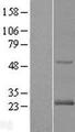 RAB24 Protein - Western validation with an anti-DDK antibody * L: Control HEK293 lysate R: Over-expression lysate