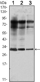 RAB25 Antibody - Western blot using Rab25 mouse monoclonal antibody against MCF-7 (1), T47D (2) and GC7901 (3) cell lysate.