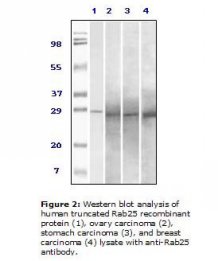 RAB25 Antibody