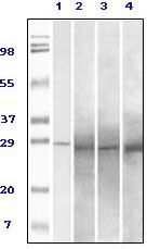 RAB25 Antibody - RAB25 Antibody in Western Blot (WB)