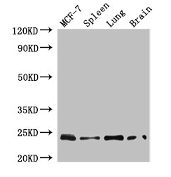 RAB25 Antibody - Western Blot Positive WB detected in: MCF-7 whole cell lysate, Mouse spleen tissue, Mouse lung tissue, Mouse brain tissue All lanes: RAB25 antibody at 4µg/ml Secondary Goat polyclonal to rabbit IgG at 1/50000 dilution Predicted band size: 24 kDa Observed band size: 24 kDa