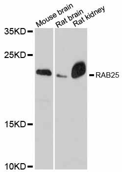 RAB25 Antibody - Western blot analysis of extracts of various cell lines, using RAB25 antibody at 1:3000 dilution. The secondary antibody used was an HRP Goat Anti-Rabbit IgG (H+L) at 1:10000 dilution. Lysates were loaded 25ug per lane and 3% nonfat dry milk in TBST was used for blocking. An ECL Kit was used for detection and the exposure time was 90s.