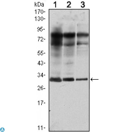 RAB25 Antibody - Western Blot (WB) analysis using Rab 25 Monoclonal Antibody against MCF-7 (1), T47D (2) and GC7901 (3) cell lysate.