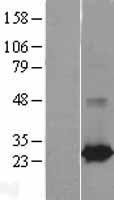 RAB25 Protein - Western validation with an anti-DDK antibody * L: Control HEK293 lysate R: Over-expression lysate